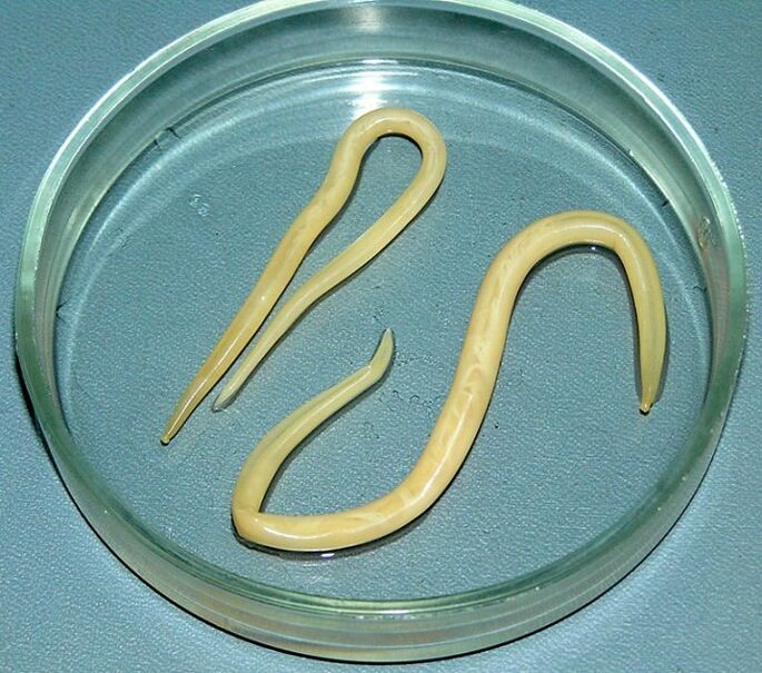 worm parasite from the human body