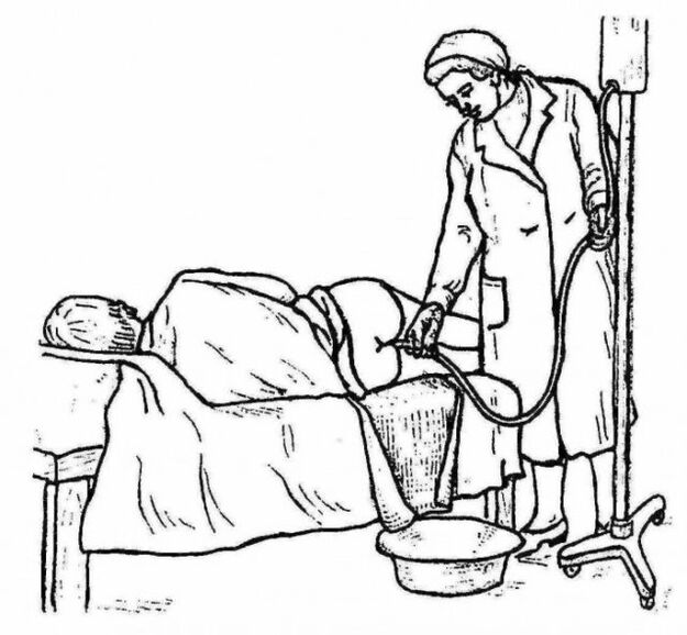 The process of enemas to clean the intestines from worms