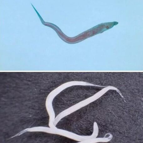 Types of parasites in human body