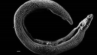 What parasites can live in the liver of a person