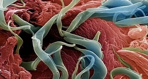 A picture of parasites in the human body