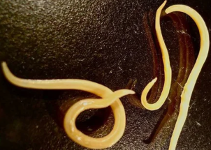 Worms, protozoa