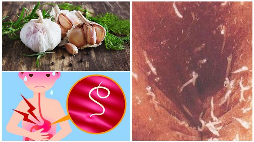 Fight garlic with parasites in the body